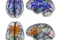 Istraživanje o povezanosti neurona u mozgu otkriva upečatljive razlike između muškaraca i žena