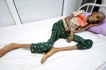 UN: U Jemenu će milioni umrijeti od gladi zbog saudijske blokade