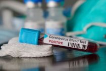 U Bosni i Hercegovini 212 novozaraženih koronavirusom, pet osoba preminulo