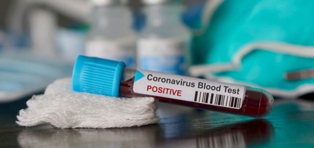U Bosni i Hercegovini 212 novozaraženih koronavirusom, pet osoba preminulo