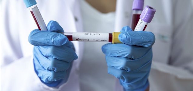 U Bosni i Hercegovini još 293 osobe zaražene koronavirusom
